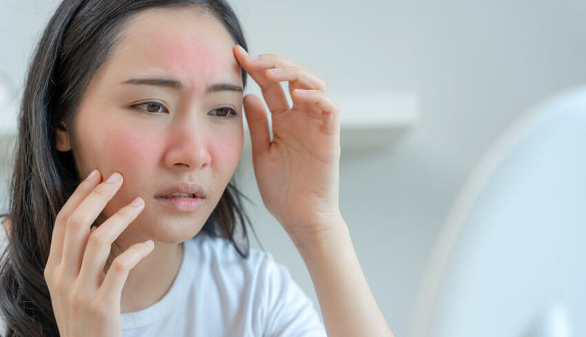 5 Signs Your Skin Is Reacting & How To Fix It